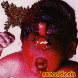 Viscera Infest - Sarcoidosis '2007