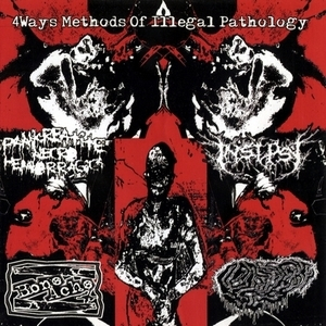 4 Ways Methods Of Illegal Pathology