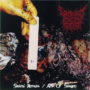 Skeletal Remains / Acts Of Savagery