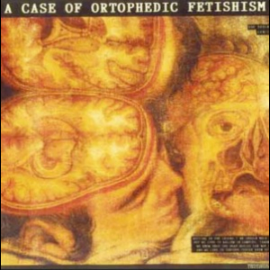 A Case Of Ortophedic Fetishism
